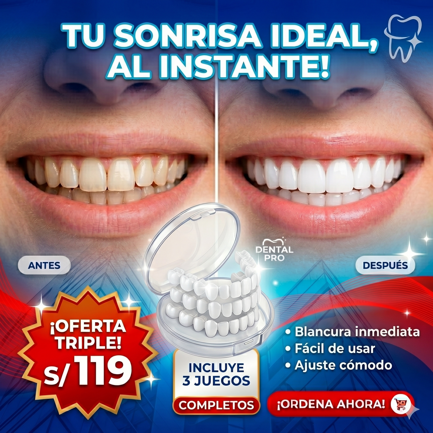 ¡Sonríe con Confianza en Segundos!-Carilla dental