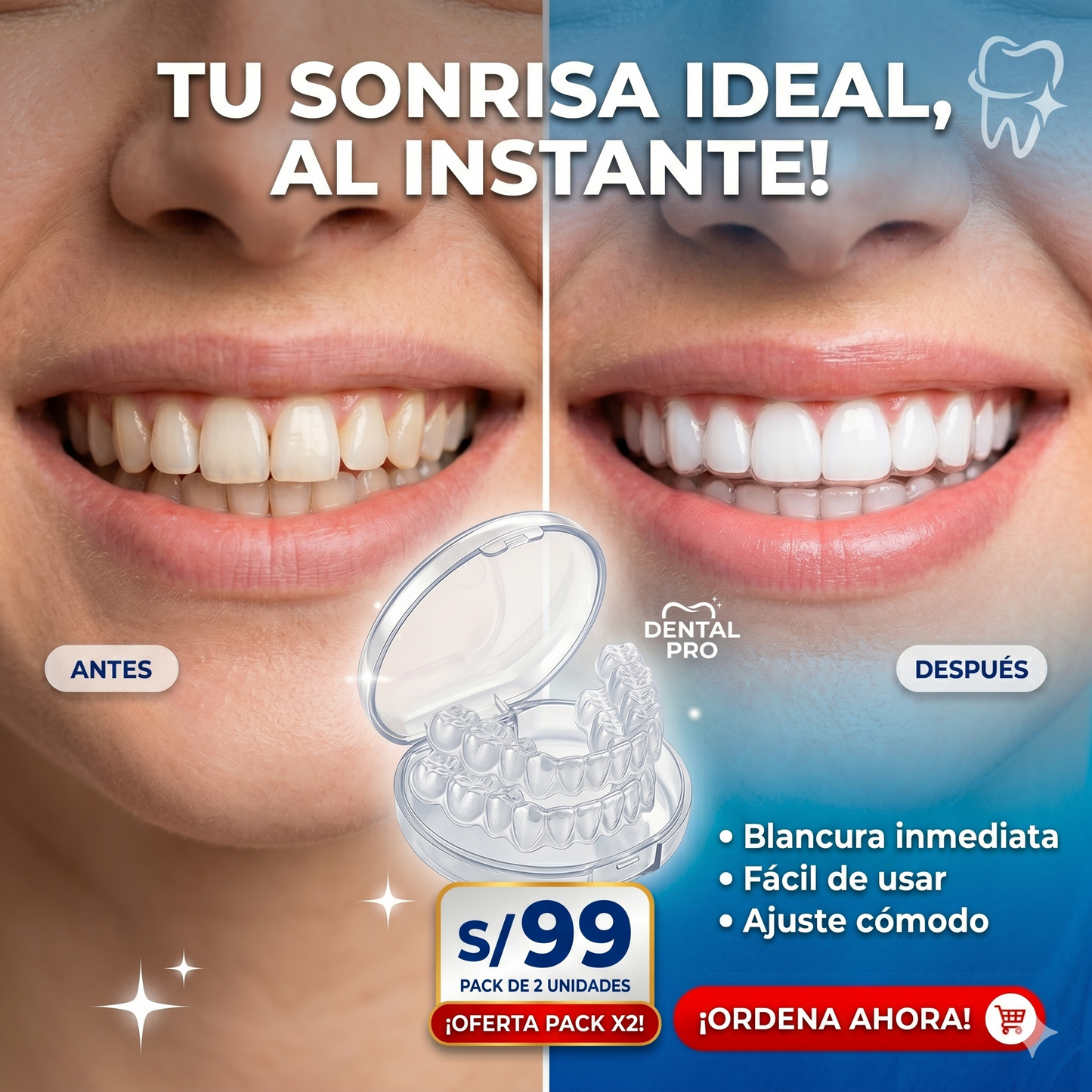 ¡Sonríe con Confianza en Segundos!-Carilla dental