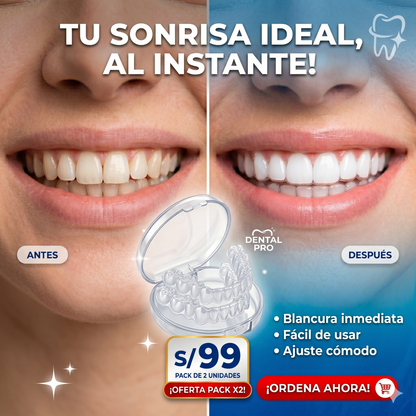 ¡Sonríe con Confianza en Segundos!-Carilla dental